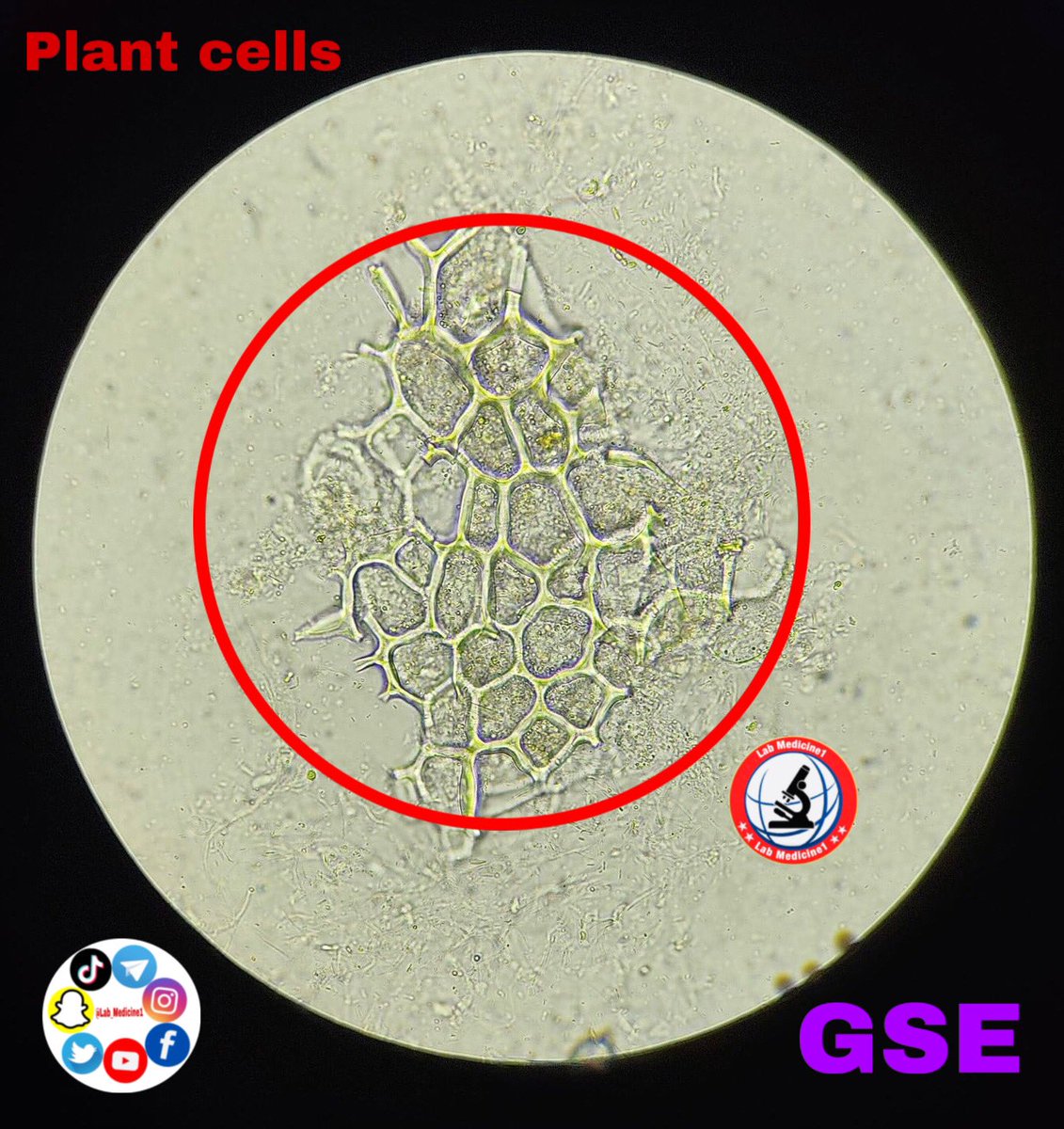 Lab_Medicine1's tweet image. #plant cells #undigested food #gse youtube.com/@Lab_Medicine1