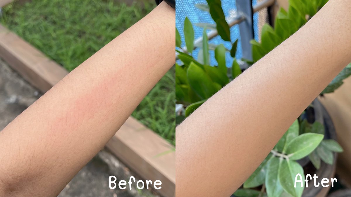 อวยรอบที่ล้าน Eucerin urea repair plus ตัวนี้กู้ผิวจริง ใช้มาห้าขวดละ ประเด็นคือเราเป็นคนผิวแพ้ง่าย แค่เกาก็ขึ้นเป็นรอยแดงแล้ว พอทายูเซอรินตัวนี้ก็ทำให้ผิวชุ่มชื้นขึ้น ไม่ขึ้นผื่นเลย ลูกรักสุดดดด 🫶🏻🤍