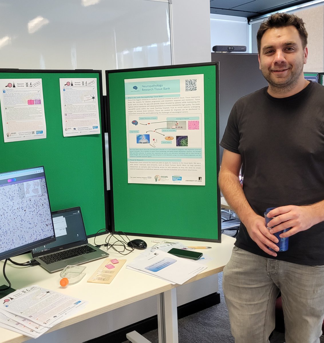 Lucy Stead (@lucyfstead) on Twitter photo Wonderful to see the <a href="/LeedsNeuroRTB/">Leeds Neuropathology Research Tissue Bank</a> manager, Steven Pollock, at the <a href="/UniversityLeeds/">University of Leeds</a> Technican Expo event yesterday, explaining about what goes into collecting and processing brain tissue to facilitate cutting edge research <a href="/UoL_technicians/">Technically Speaking</a> @MedicineDean <a href="/LIMRLeeds/">LIMRLeeds</a> Wonderful to see the <a href="/LeedsNeuroRTB/">Leeds Neuropathology Research Tissue Bank</a> manager, Steven Pollock, at the <a href="/UniversityLeeds/">University of Leeds</a> Technican Expo event yesterday, explaining about what goes into collecting and processing brain tissue to facilitate cutting edge research <a href="/UoL_technicians/">Technically Speaking</a> @MedicineDean <a href="/LIMRLeeds/">LIMRLeeds</a>