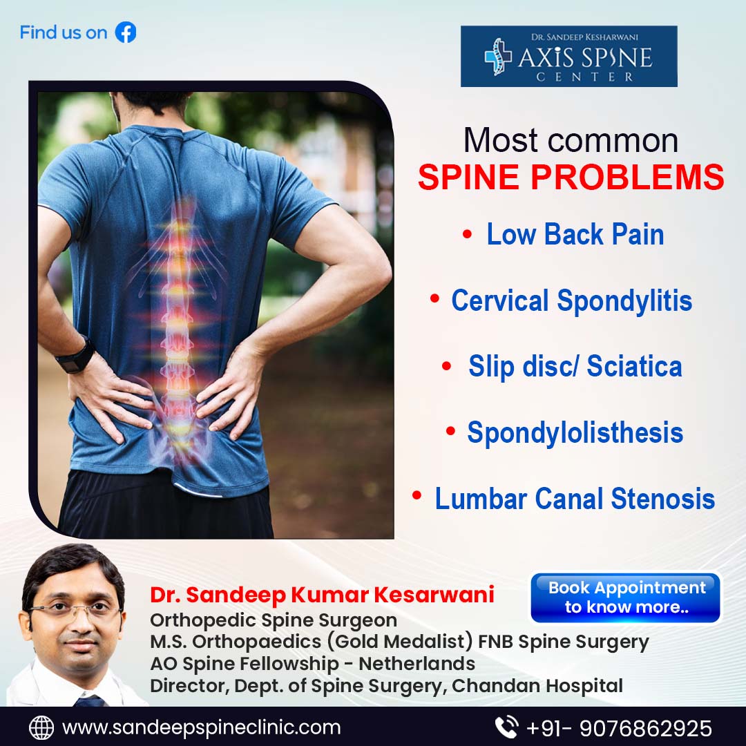keshar_wani's tweet photo. "Most Common #SpineProblem"
Axis Spine Center - Dr. Sandeep Kr. Kesharwani
Phone: 089482 57043
Website: https://t.co/GloyCMQ7ZW
#DrSandeepKesharwani #AxisSpineCenter #SpineSpecialist #SpineDoctor #SpineProblems #LowerBackPain #DigiSurgeon #SpinalStenosis #Spinaltuberculosis https://t.co/LHkB7PnfTm