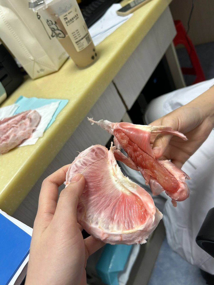 坐等下班了😂😂 #护士 #同城