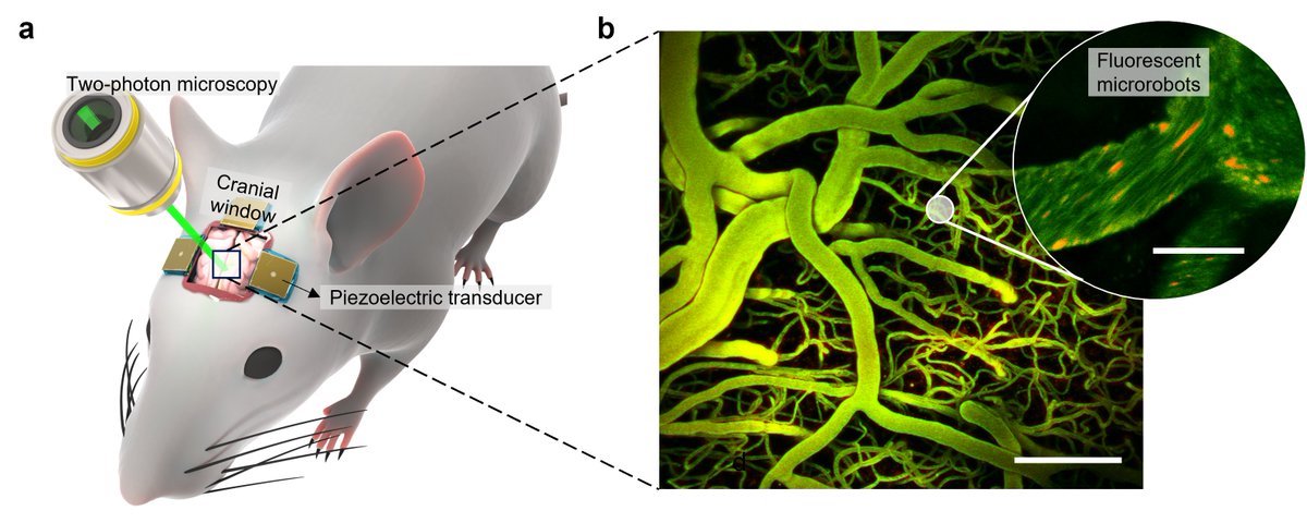 Alexia Del Campo Fonseca (@alexiacfonseca_) on Twitter photo I'm delighted to share our new paper published in #NatureCommunications. Ultrasound microrobots navigated inside the brain vasculature for the first time.
Promising technology for the treatment of neurological diseases. <a href="/ETH_en/">ETH Zurich</a>
Read here: rdcu.be/dmJmV A thread (1/3) I'm delighted to share our new paper published in #NatureCommunications. Ultrasound microrobots navigated inside the brain vasculature for the first time.
Promising technology for the treatment of neurological diseases. <a href="/ETH_en/">ETH Zurich</a>
Read here: rdcu.be/dmJmV A thread (1/3)