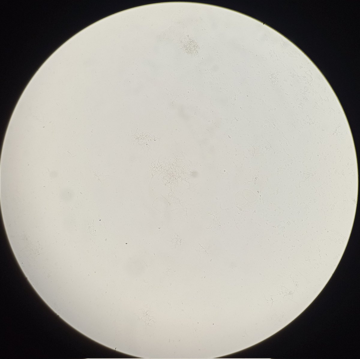 Broncoaspirado de paciente con enfermedad pulmonar crónica y bronquiectasias, observada al 🔬 con 3 métodos distintos.

¿🦠?
¿Cuáles son las técnicas del 🔬 y cuáles son sus ventajas?

<a href="/felipfalciparum/">Felipe Pérez-García, PhD</a> 
<a href="/jose_pepote/">Jose Sanchez</a>
