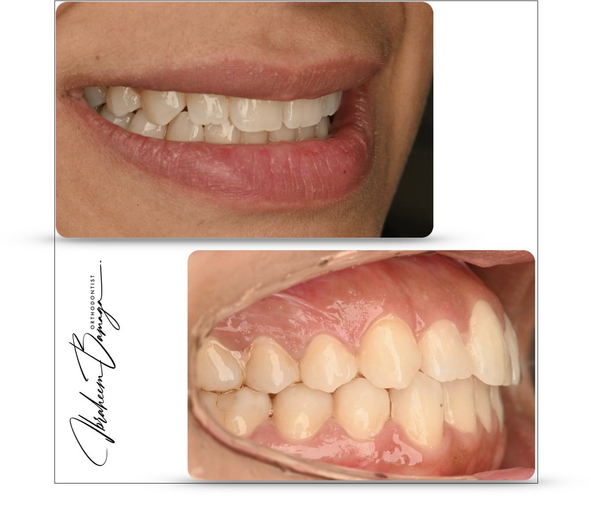 في #اليوم_الوطني 
اكيد الابتسامة حتكون جميلة