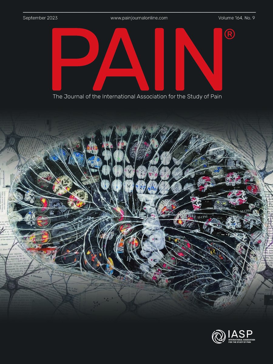 Kathleen Sluka (@ksluka0101) on Twitter photo Our new paper describing the <a href="/a2cps_pain/">A2CPS - Acute to Chronic Pain Signatures</a> published in <a href="/PAINthejournal/">PAIN Journal</a>. The cover image "Pain Brain" is a multimedia piece collaged with brain scans from published papers in pain including co-author <a href="/torwager/">tor wager</a>. Open Access. #painawarenessmonth #sciart
journals.lww.com/pain/fulltext/… Our new paper describing the <a href="/a2cps_pain/">A2CPS - Acute to Chronic Pain Signatures</a> published in <a href="/PAINthejournal/">PAIN Journal</a>. The cover image "Pain Brain" is a multimedia piece collaged with brain scans from published papers in pain including co-author <a href="/torwager/">tor wager</a>. Open Access. #painawarenessmonth #sciart
journals.lww.com/pain/fulltext/…