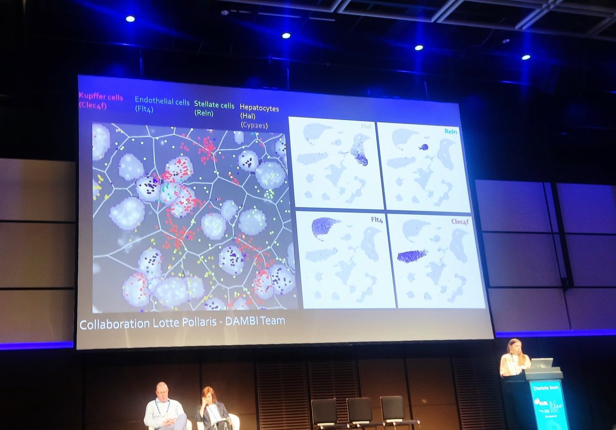 Macrophages and MASLD. Great talk by @KC_DC_01 !
#SLDSummit @EASLnews