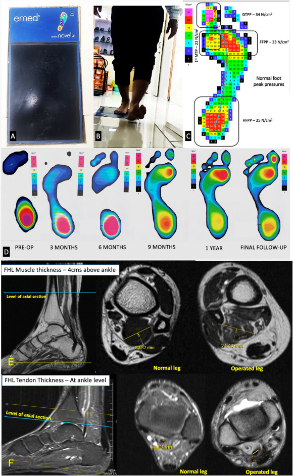 Journal of ISAKOS tweet media