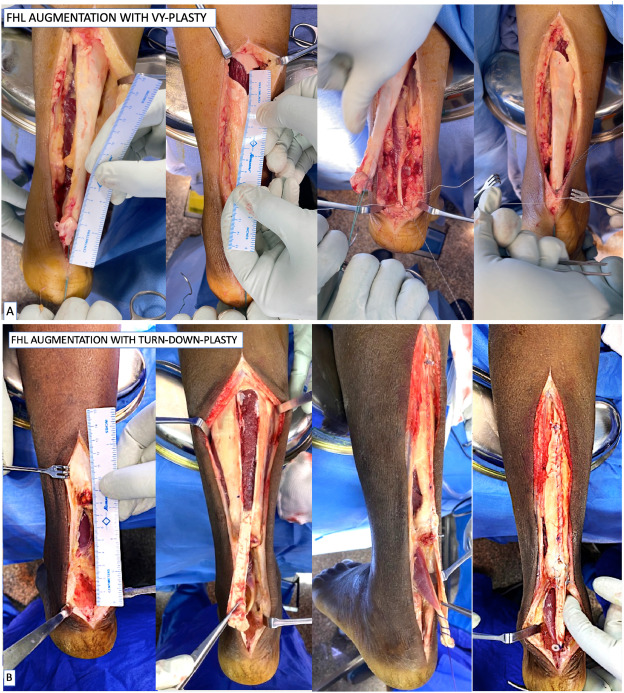 Journal of ISAKOS tweet media