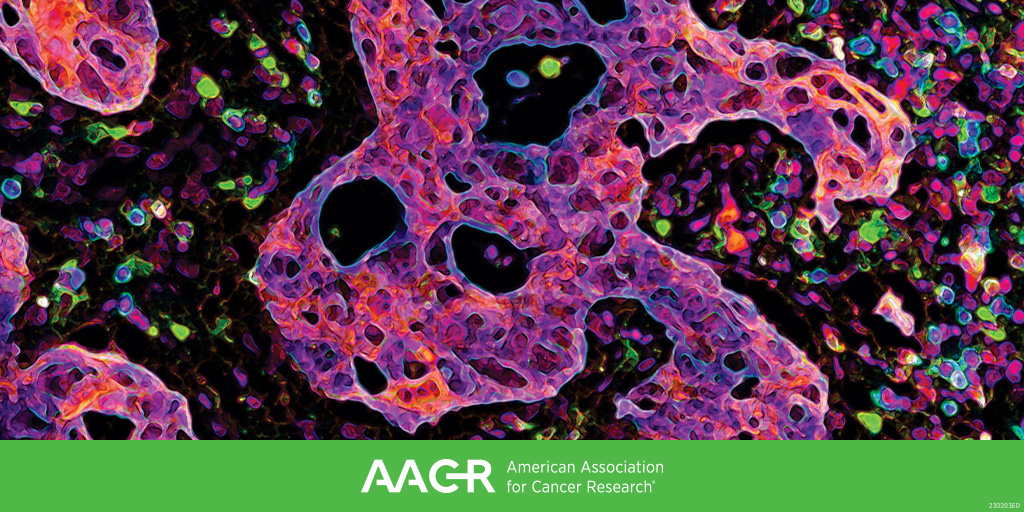 Macrophages and Myeloid Cells: @MaxKrummel, @AaronNewmanLab, @JennGuerriero, and Joseph T. Greene will address this topic in a plenary session at the AACR Special Conference on Tumor Immunology and Immunotherapy (Oct 1-4, Toronto). Learn more: bit.ly/3Pr1bqV #AACRtii23