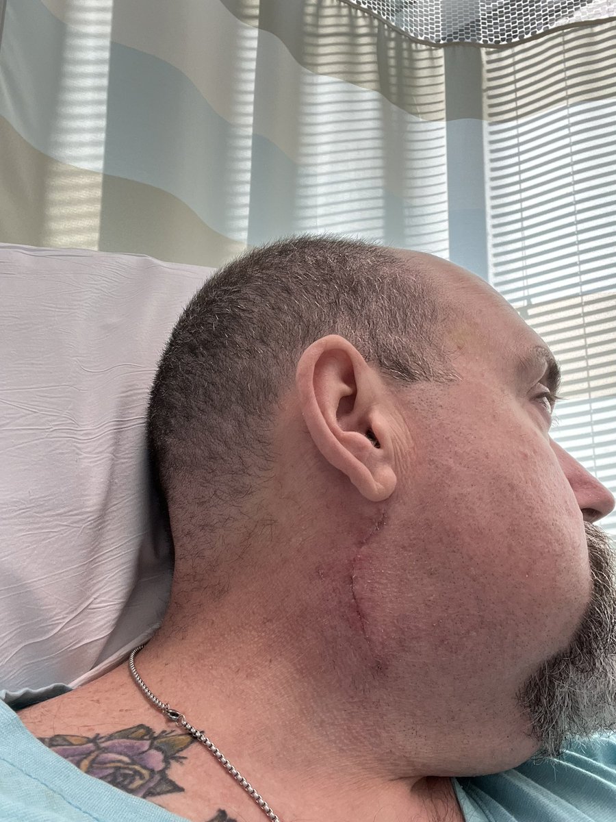 Finneas_Ryder's tweet photo. Well. Today’s photos. My surgical incision 16 days out. And today is my monthly plasma infusion, the 7 hour countdown has started. Donate plasma my friends, help save a life.  #normalizenudism #normalizenaturism #barebear #nudist #naturist #baredlife #bodypositive #gaynudist https://t.co/uZGNs3HPi7