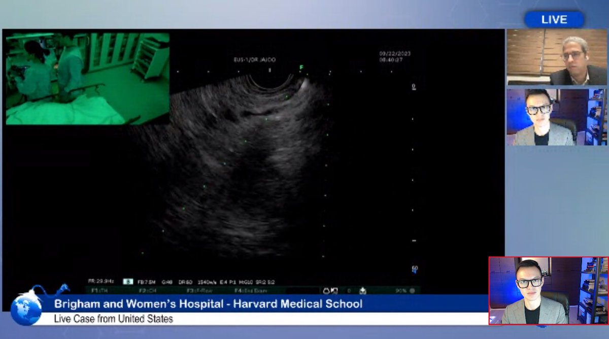 It’s always a special feeling watching a former co-fellow execute a procedure flawlessly at a live conference! 🔥 Great job @SighPichamol with the live demo of portal pressure gradient measurement in front of thousands of viewers at @BariatricLive!!! 🙌 #GITwitter #BELG2023