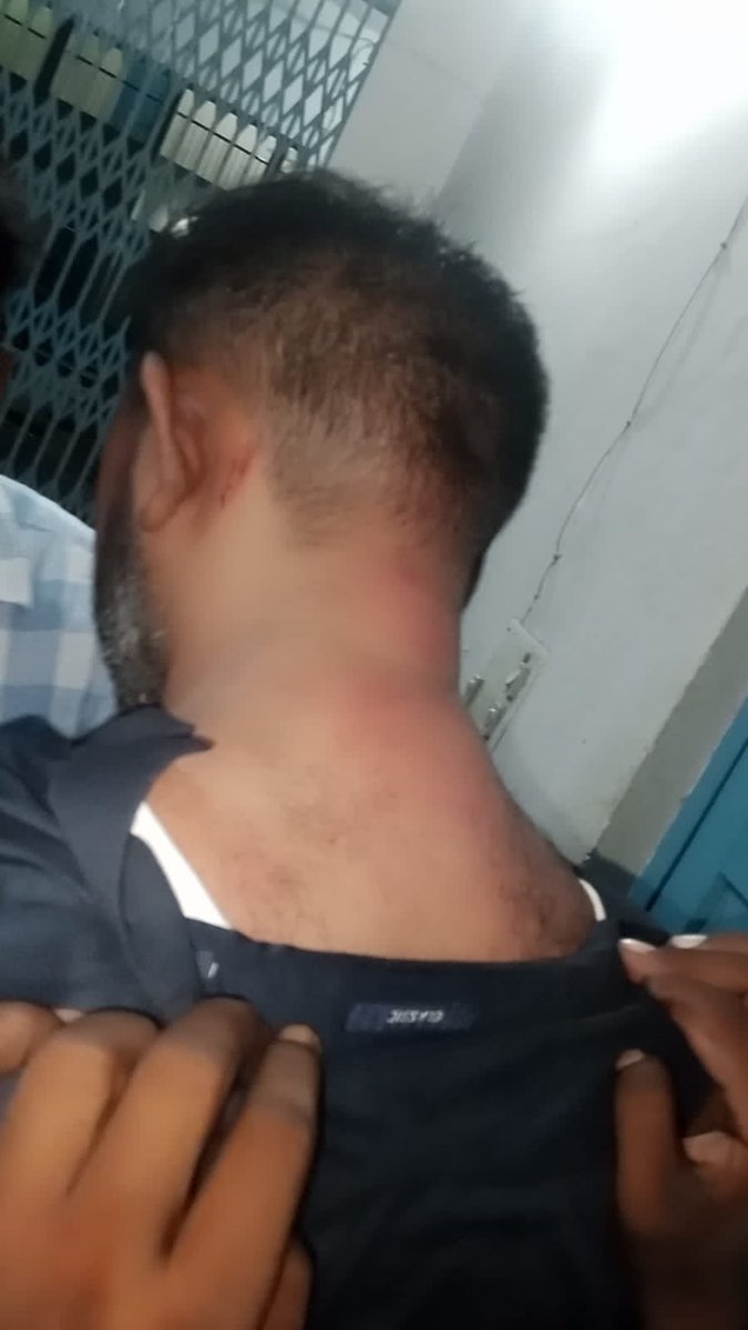 aqliyatihuqooq's tweet photo. TW ⚠️ 

Pictures of Luke Victor in Saddar Thana Faisalabad after his release shows him covered in bruises. He was beaten &amp; manhandled for seeking the truth about Pastor Eliezer, also known as Vicky, who was shot after the Jaranwala incident. 1/2 🧵 https://t.co/wcKi7T2CKj