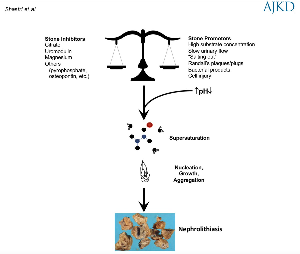 Kidney Stone Pathophysiology, Evaluation and Management: Core Curriculum 2023 

buff.ly/46fO3Mc (FREE)

<a href="/KSamKidney/">Kamalanathan Sambandam</a> <a href="/EleanorLederer/">Eleanor Lederer</a> <a href="/UTSWNephrology/">UTSW Nephrology</a>