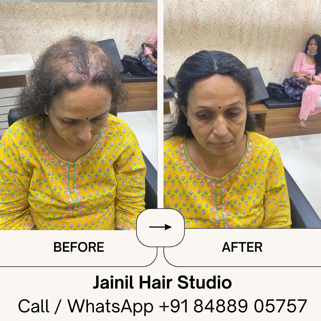 HairJainil's tweet photo. Jainil Hair Studio Vadodara best Hair Wig &amp; Hair Treatment, hair Fixing, Hair weaving, Bonding &amp; grafting for Men, Hair Implementation, Silicon Bonding.  Call us or WhatsApp us on 8488905757   https://t.co/ra847CBPQK #vadodara #baroda #amitnagar #hairstudio https://t.co/lr7msaKiWS