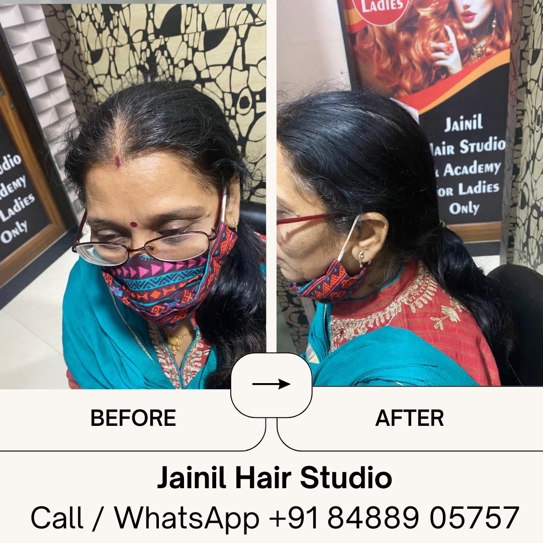 HairJainil's tweet photo. Jainil Hair Studio Vadodara best Hair Wig &amp; Hair Treatment, hair Fixing, Hair weaving, Bonding &amp; grafting for Men, Hair Implementation, Silicon Bonding.  Call us or WhatsApp us on 8488905757   https://t.co/ra847CCnGi #vadodara #baroda #amitnagar #hairstudio https://t.co/X4ftsu5X1F