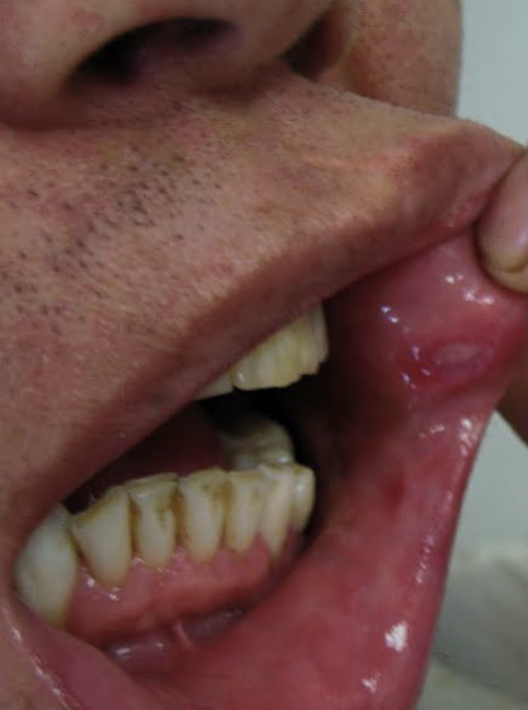 Karan Anandpara tweet media