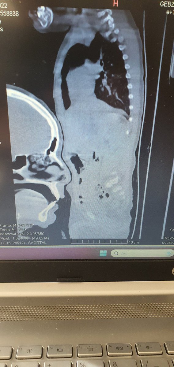 Tomografi çekiminde 18 aylık bebeğinin hareketini engellemek isteyen anne çekime dahil olursa🙃