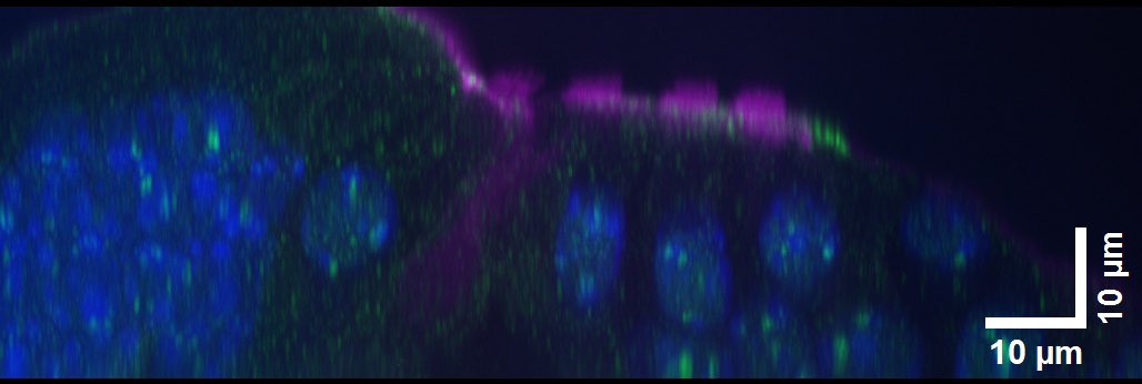 HearingShef's tweet photo. We’ve got a late #FluorescentFriday for you all, courtesy of Charlie. The image on the left is a top-down view of the all important organ of Corti, whilst the image on the right is a side-on view of the same bit of tissue.

Have a great weekend! https://t.co/U6PHwJe7gP
