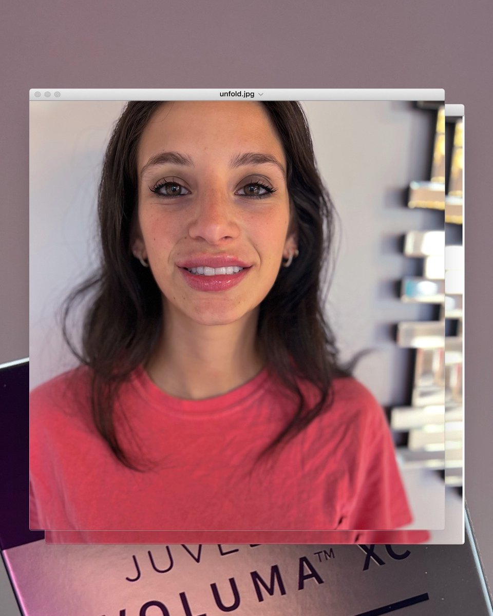 RadianceAF's tweet image. Here is the after! Plumped to perfection by injector Susan Mowry!💋