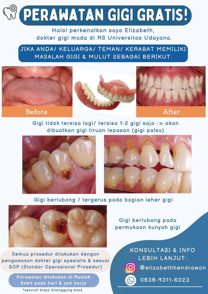 BEERgitha's tweet photo. @sirupbuah Haii kak maaf OOT, tp jika ada yg domisili di denpasar jimbaran bali bisa hubungin adik ku yah! Perawatan gigi gratisss 😊😊 https://t.co/o0xgofTOmB