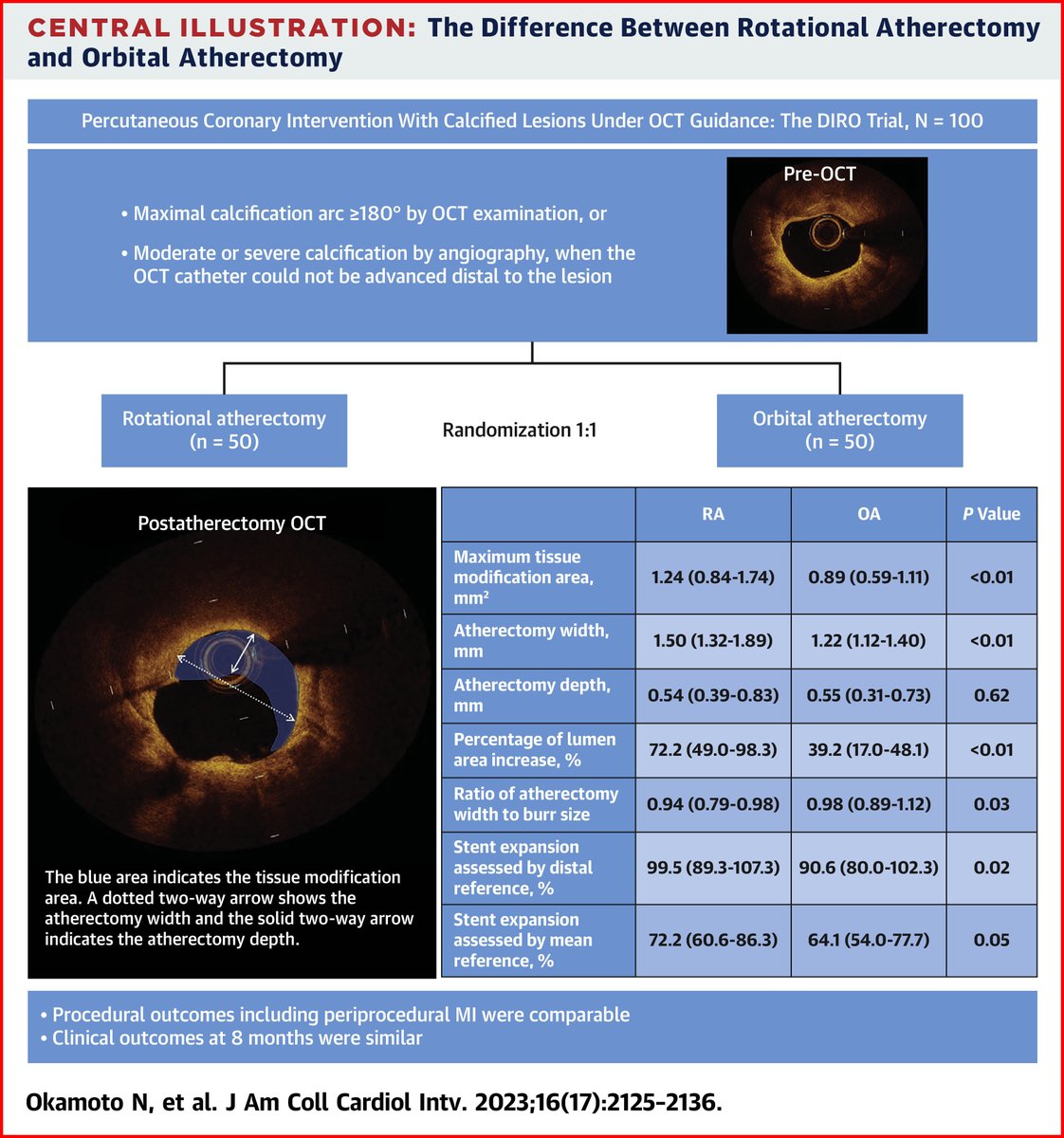 Comparing rotational vs orbital atherectomy by OCT for calcified lesions: The prospective randomized DIRO trial revealed RA could produce a more favorable tissue modification, leading to larger stent expansion than OA in heavily calcified lesions. bit.ly/48r8Deh #JACCINT