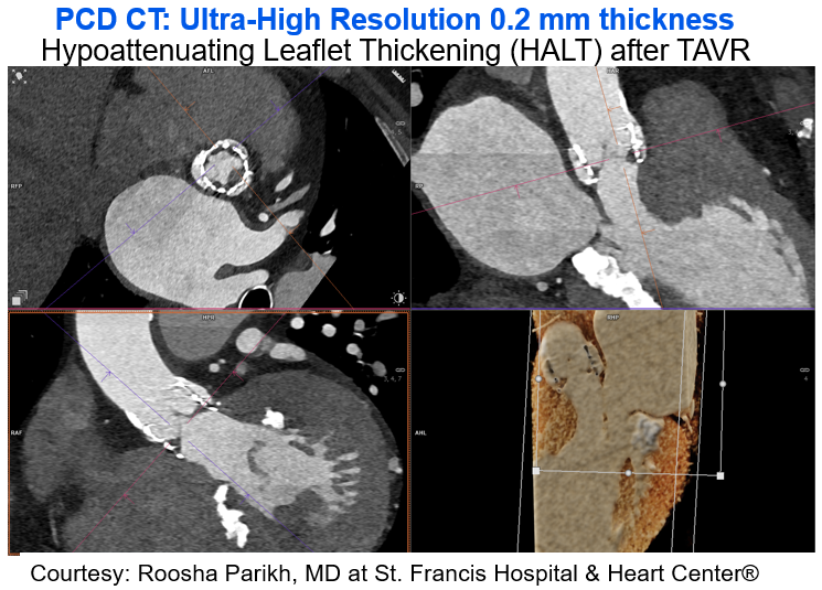 Roosha Parikh tweet media