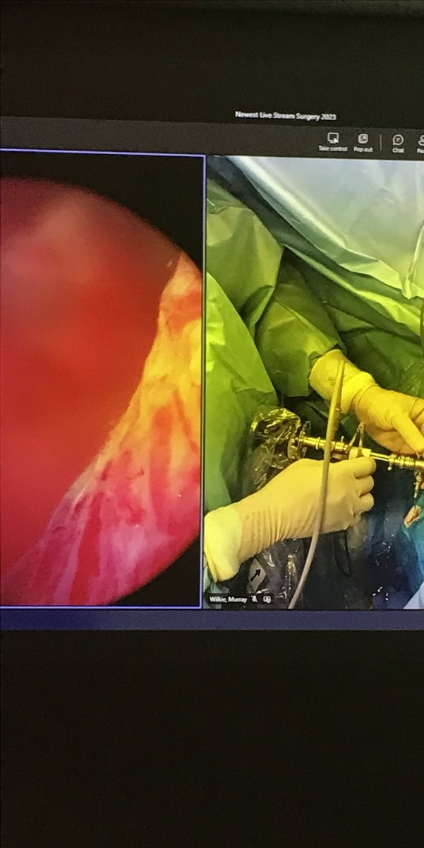 abigailrnelson's tweet photo. Fantastic couple of days at the Edinburgh Bladder Cancer Workshop learning from live surgery and talks! Thank you to @ParamMariappan and the very impressive faculty / industry reps. https://t.co/X9Y6eG9fLc