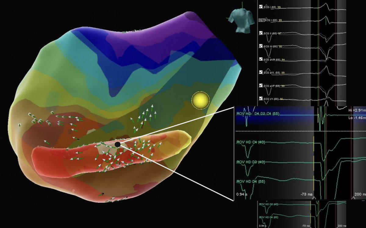 EP in the OC tweet media