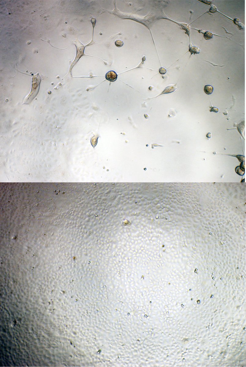 Images of SARS-CoV-2 cultures often tell us a thousand words. Here we have the Omicron lineage XBB.1.5 growing in two engineered cells. Both equally express ACE2 and TMPRSS2. Visually this sums up our journey into the complicated entry pathway of Omicron lineages......1/