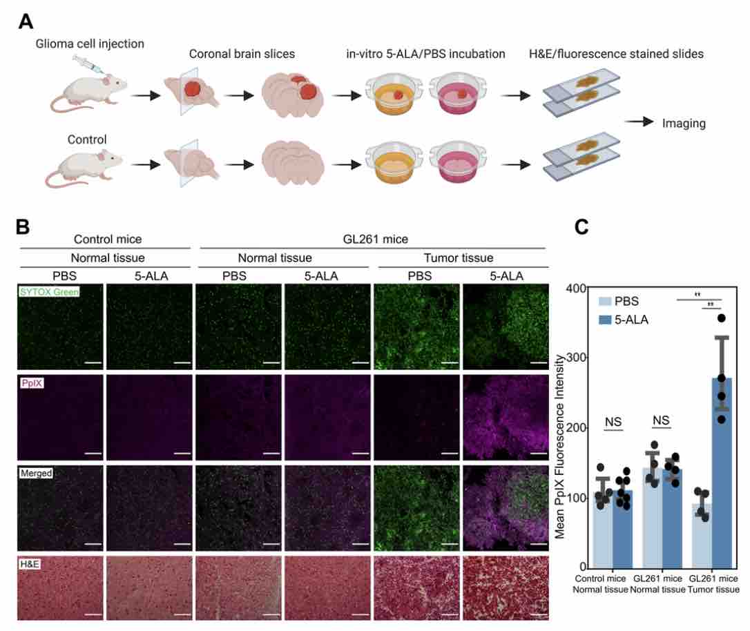 Journal of Neurosurgery tweet media