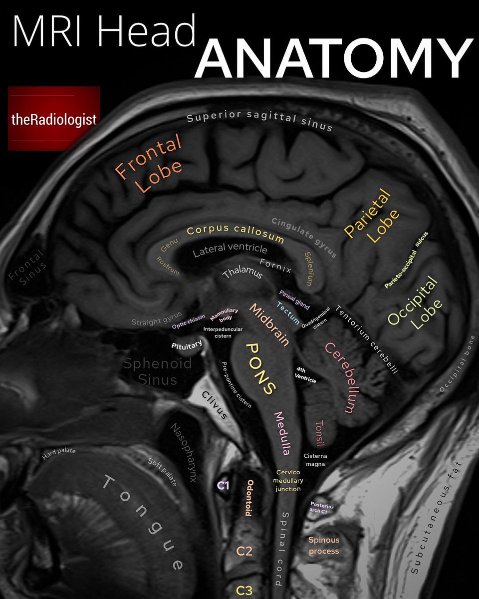 radiologistpage's tweet photo. T1 weighted sagittal view of an MRI brain https://t.co/zLWlEIcoal