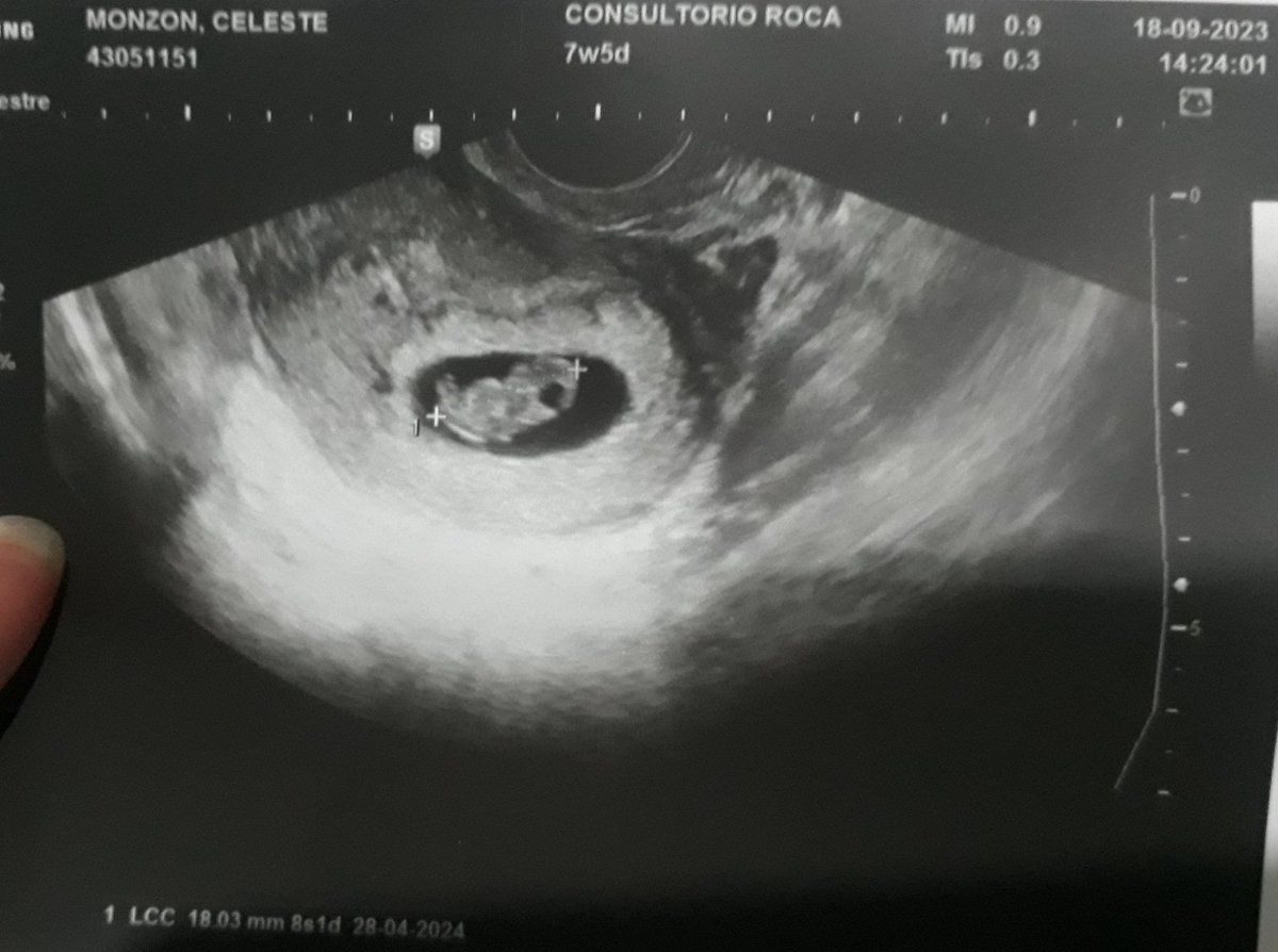Manejamos mucha felicidad por acá♥️
Bebito en camino