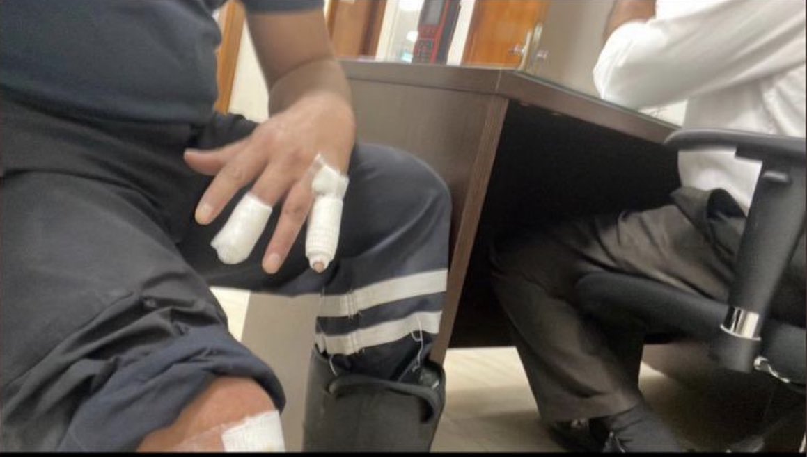 احد ابطال فريق الاطفاء والذي تعرض للاصابة أسامة دشتي في مكافحة حريق #ميناء_الاحمدي  
حمدالله علي السلامه يابوزيد 
#القطاع_النفطي