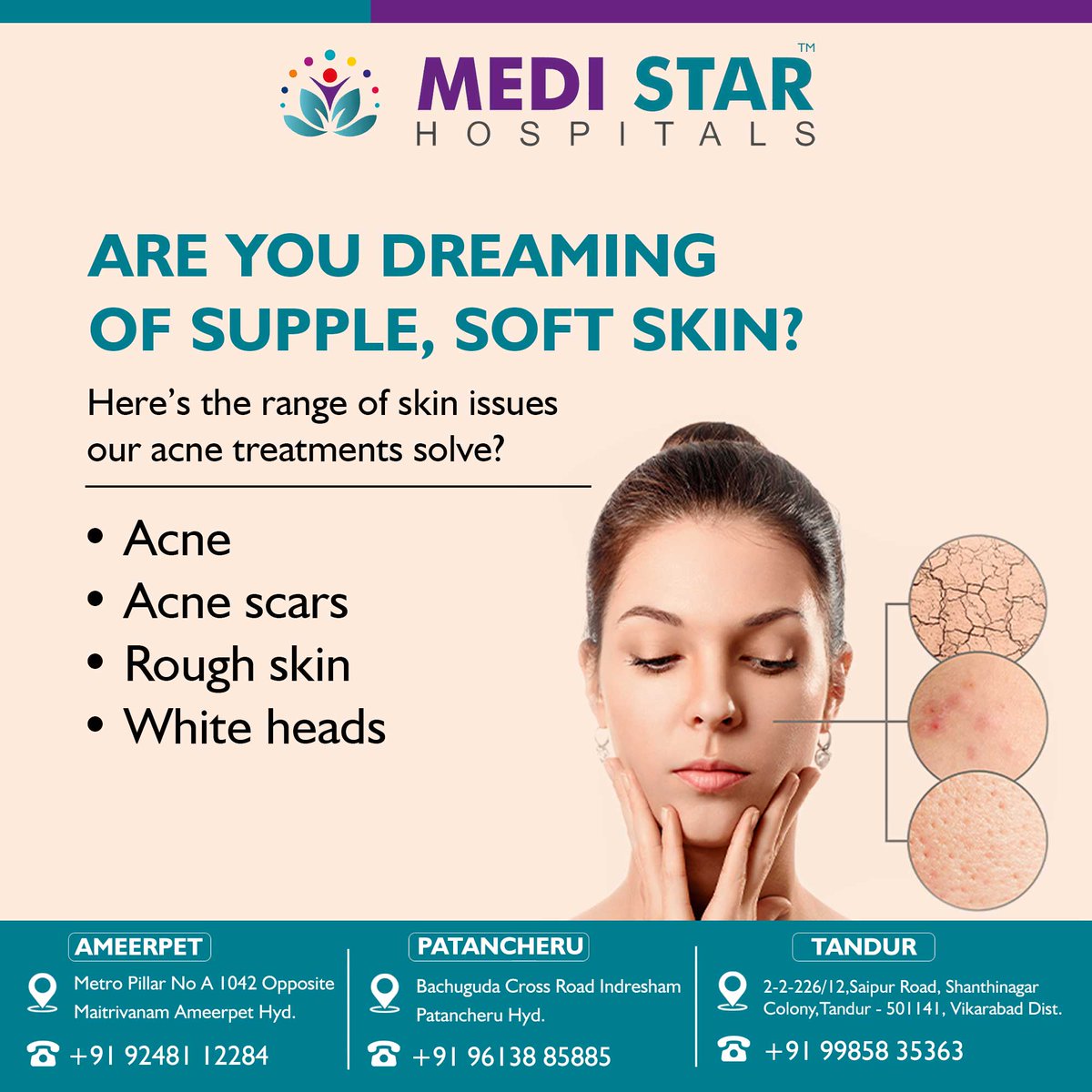 medi_hospitals's tweet image. Indulge in the dream of supple, soft skin that whispers self-care and radiance.
#SoftSkin #SuppleSkin #SkinCare #HealthySkin #GlowingSkin #SkinGoals #SmoothSkin #NourishedSkin #SkincareRoutine #RadiantSkin #Medistarhospital #patancheruvu #Ameerpet #Hyderabad