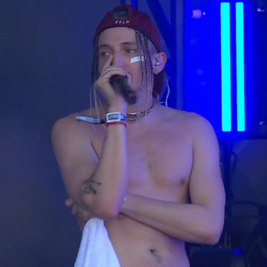 also i noticed that mitchel has a little scar on his face so thats why he was having this on his face on lollapalooza ig 😭