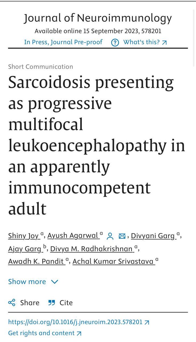 Ayush A (@drayushagarwal) on Twitter photo We have highlighted that PML should be a differential diagnosis in all patients with tumefactive demyelination, even in apparently immunocompetent adults <a href="/JournalofNeuro1/">Journal of Neuroimmunology</a> <a href="/Divyani_Garg/">Divyani</a> <a href="/achalaiims/">Achal Srivastava</a> <a href="/DivyaRadhakri17/">Divya Radhakrishnan</a> #Neurosarcoidosis #sarcoidosis We have highlighted that PML should be a differential diagnosis in all patients with tumefactive demyelination, even in apparently immunocompetent adults <a href="/JournalofNeuro1/">Journal of Neuroimmunology</a> <a href="/Divyani_Garg/">Divyani</a> <a href="/achalaiims/">Achal Srivastava</a> <a href="/DivyaRadhakri17/">Divya Radhakrishnan</a> #Neurosarcoidosis #sarcoidosis