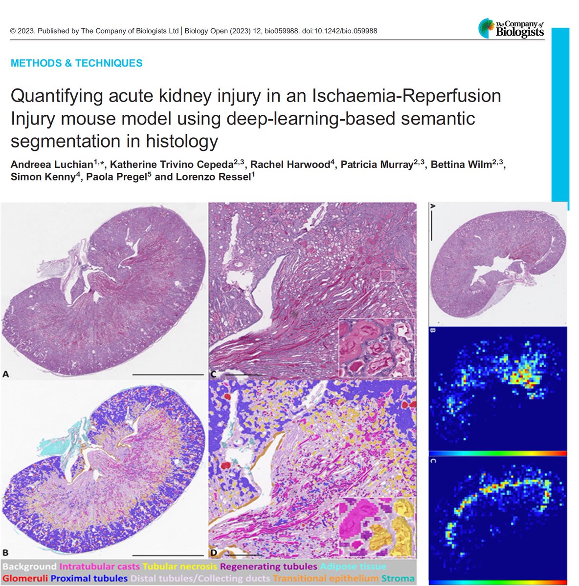 Latest paper from Andreea Luchian @DiMoLab: “Quantifying acute kidney injury  in an Ischaemia-Reperfusion Injury mouse model using deep-learning-based  semantic segmentation in histology”.