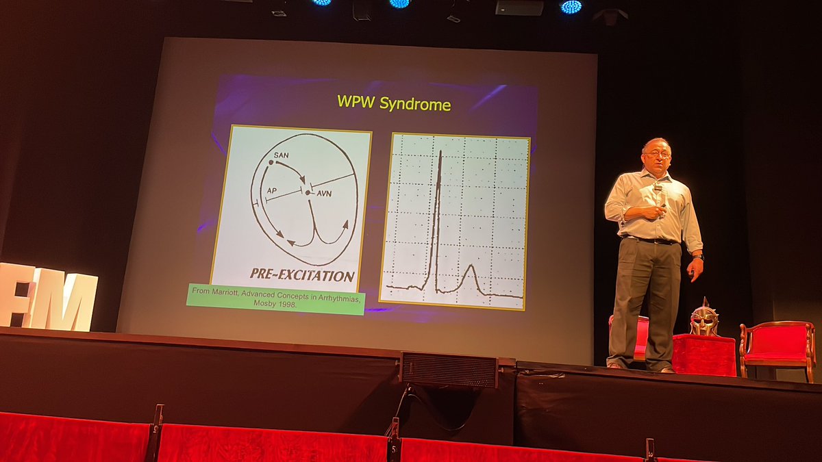 rob_cosentini's tweet photo. Arrhythmias via @amalmattu at #CorConference

Tachy with Pre-excitation 

➡️ Delta wave not always present/not all waves

➡️ look for short PR interval https://t.co/MkkK4DcsWA