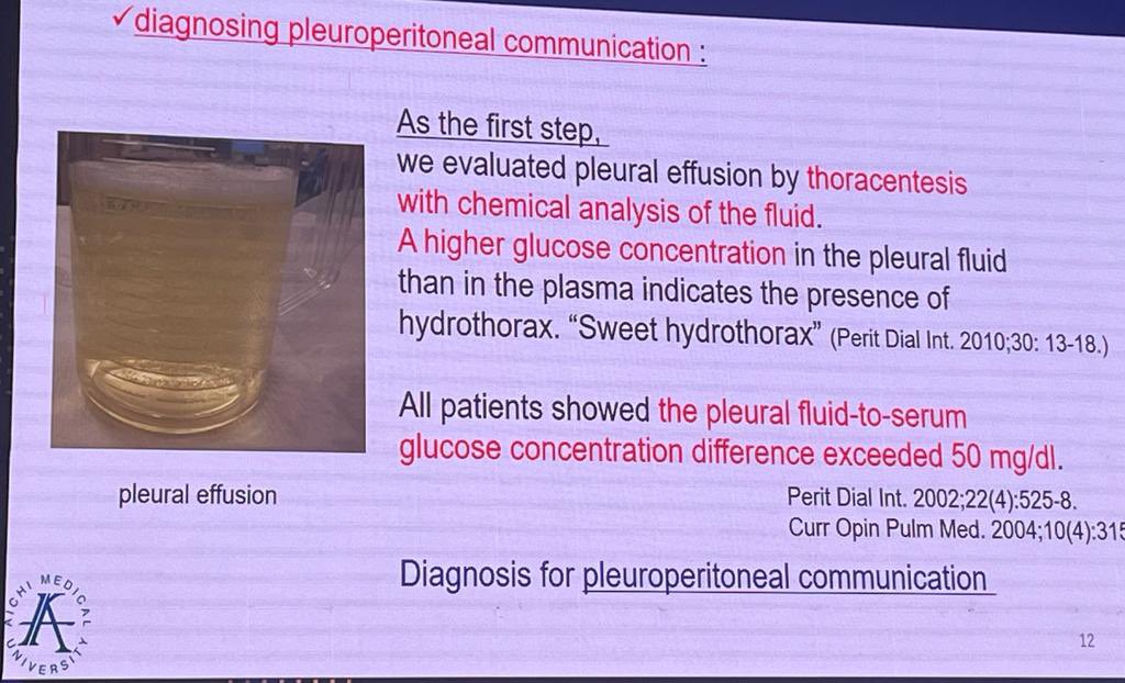 📣Pt with SWEET 🍬hydrothorax 

🤔Pt on PD-massive R pleural effusion(PE)

✅PF glucose>plasma glucose (🕵️‍♀️pleuro peritoneal PP communication 

🩻Confirm-CT peritoneography/peritoneal scintigraphy 

👩‍⚕️Tt-switch to HD/⬇️Vol PD

🔥Pleurodesis-talc/ VATS

🎙️Dr Ito #apcmispd2023