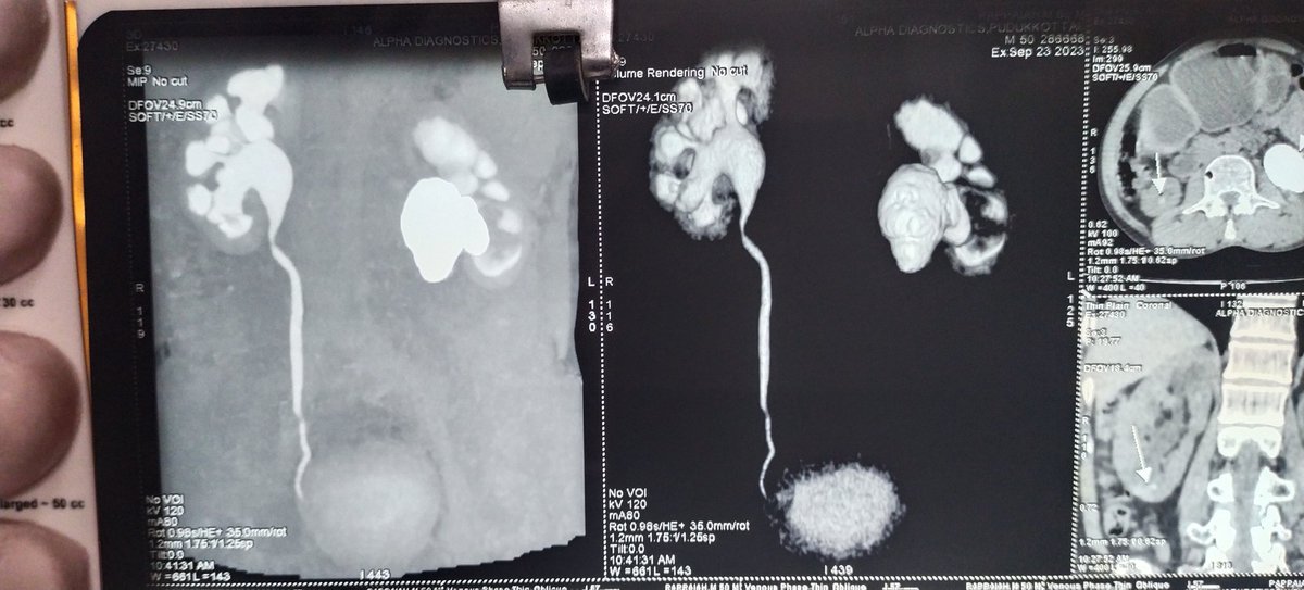 Marzook Urologist tweet media