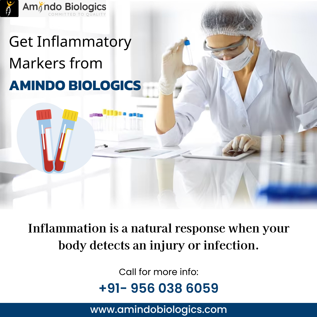 Inflammation is a natural response when your body detects an injury or infection.
#Inflammation #Health #AmindoBiologics #MedicalResearch #AmindoBiologics #GrowthMarkerELISA #ScienceInnovation #BiotechAdvancements #LifeSciences #Biotechnology  #TechInScience
#TechInScience
