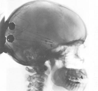 YOURWAY9's tweet photo. #aids #aidsawareness #cancer #conscious #conspiracy #deepstate #freedomthinker #hiv #hivpositive #illuminati #knowyourstatus #mindcontrol #mkultra #pizzagate #populationcontrol #qanon #redpill #savethechildren #targetedindividuals #thegreatawakening #truthseeker #wakeupsheeple https://t.co/2IL7d243Bd