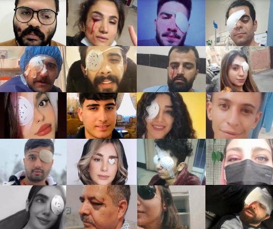 Gezielte Angriffe auf Augen von Frauen in #Iran 🧵
Die NGO <a href="/IHRights/">Iran Human Rights (IHRNGO)</a> hat die Ermordungen und Augenverletzungen von Protestierenden der “Frau Leben Freiheit”-Revolution im Jahr 2022 analysiert. Die Ergebnisse zeigen: 1/