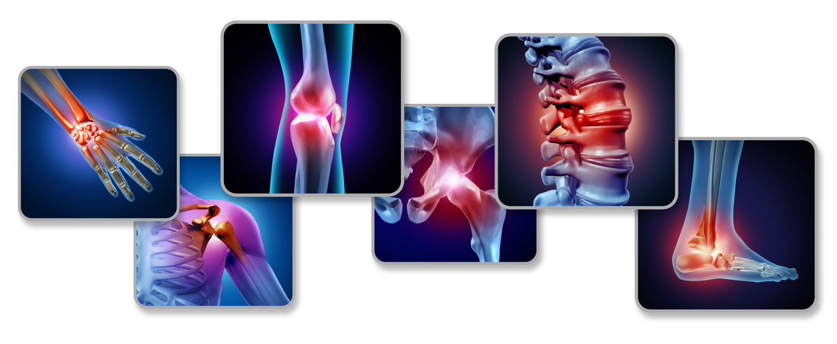 AJA_Cortes's tweet photo. THE PAIN WONT STOP UNLESS YOU LIFT

SARCOPENIA=The loss of muscle mass, 

And its the reason why being in pain is associated with getting older

 When you lose muscle mass, your joints will start to hurt, your tendons and ligaments are now handling more compression and load than before

Unfortunately, many people interpret this as a sign to stop exercising, or to WAIT until their joints dont hurt to do anything physical 

This is a critical mistake, they will KEEP HURTING unless you strength train and build muscle mass 

The more muscle you have, the less stress the joints experience