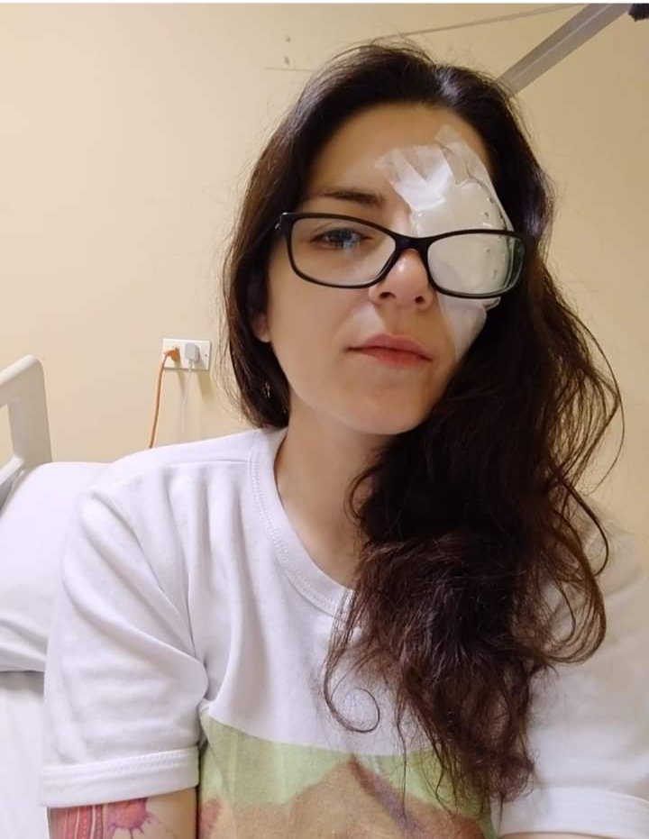 Anto2Gomez's tweet photo. Palabras de nuestra compañera
Herida en sus ojos con perdigón disparado por la policía (Pacos) https://t.co/pe9Jn5qgNo