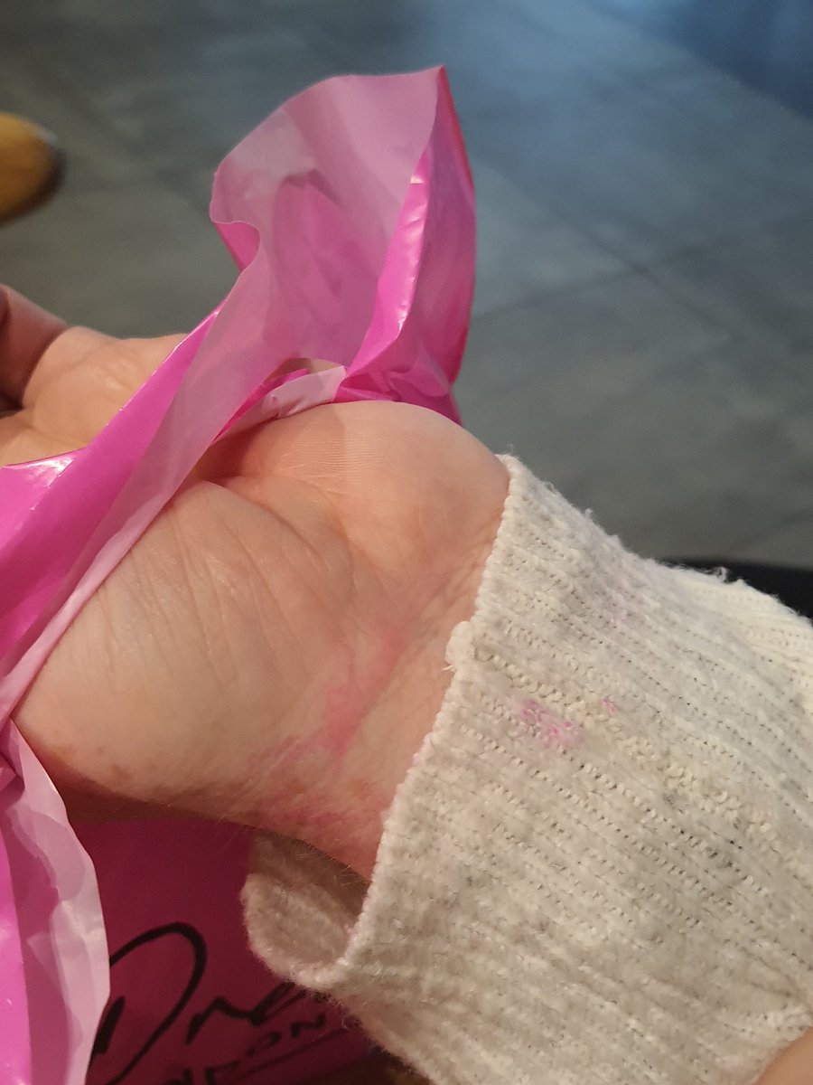 ExpFitness's tweet photo. @beauty_outlet think you are going to need to re-think your bag supplier...really hope these stains aren't permanent https://t.co/cMoIP3t0G4