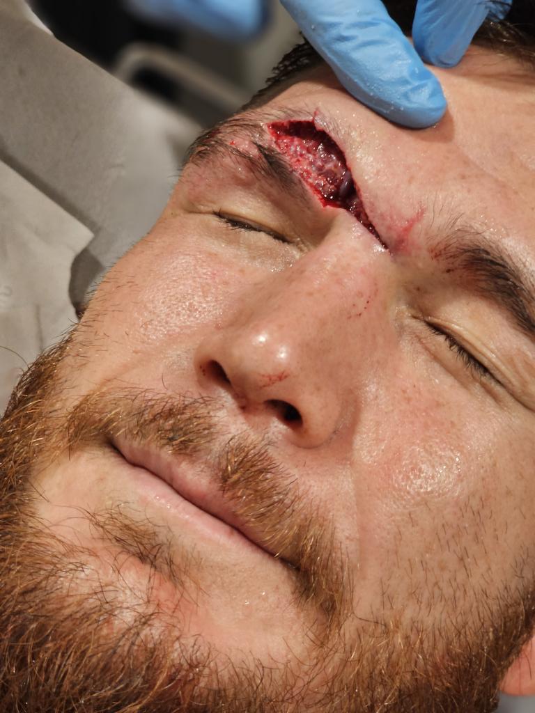 DustinPoirier's tweet photo. Champ said its just a scratch @JohnnyEblen https://t.co/iOl5WwoWZb
