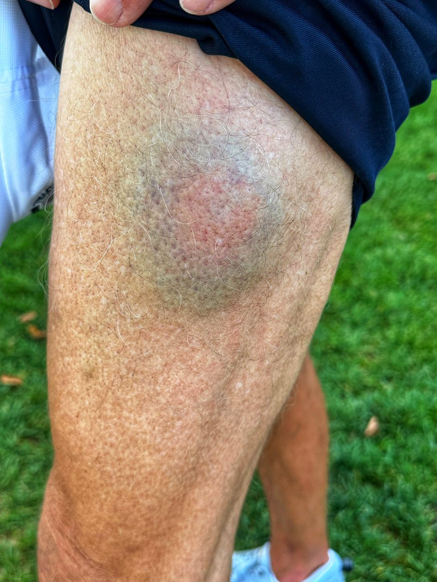 Mark the Caddie tweet media