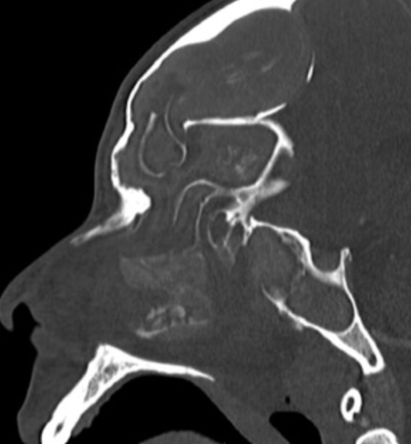 Annals of Allergy, Asthma & Immunology tweet media