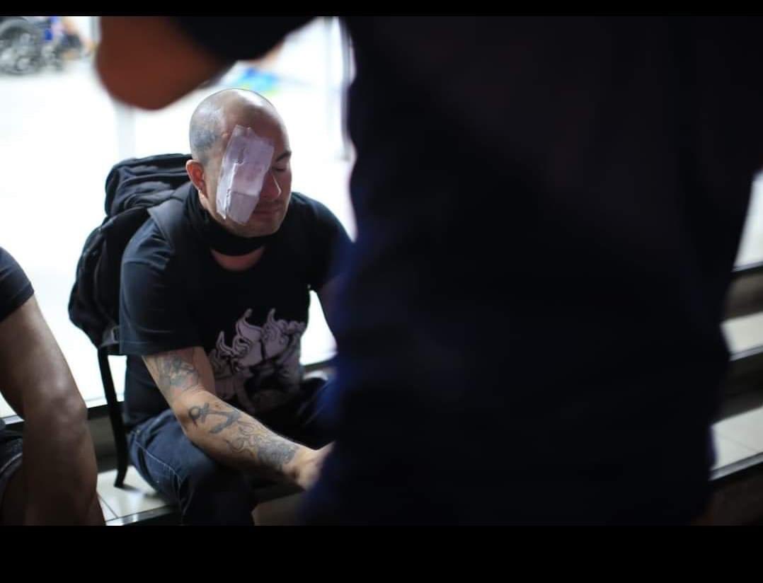 Murosyresisten's tweet photo. TESTIGOS | Sergio “Toto”, sobreviviente de Terrorismo de Estado con Piñera, necesita ubicar a testigos de la agresión que sufrió el 12 de noviembre de 2019, en Irene Morales con Alameda (frente al Crowne Plaza), a alrededor de las 19:15hrs. Quienes puedan cooperarle en la búsqueda de justicia, comunicarse por interno. Atención, Brigada Azul.